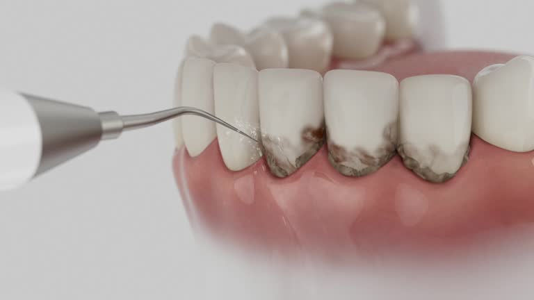Trusted Dental Implants service in Lewiston, ME - Dentist Open Now